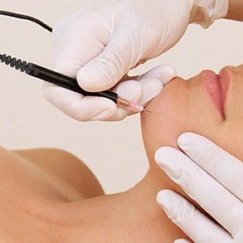 Everything-you-need-to-know-about-electrolysis